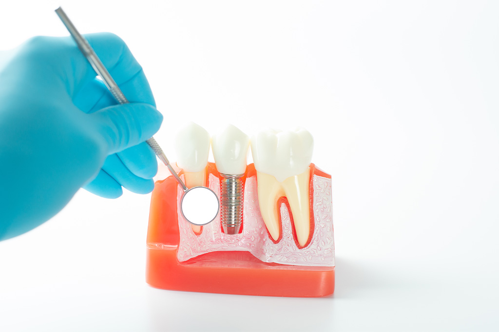 継続的なメンテナンスが必須