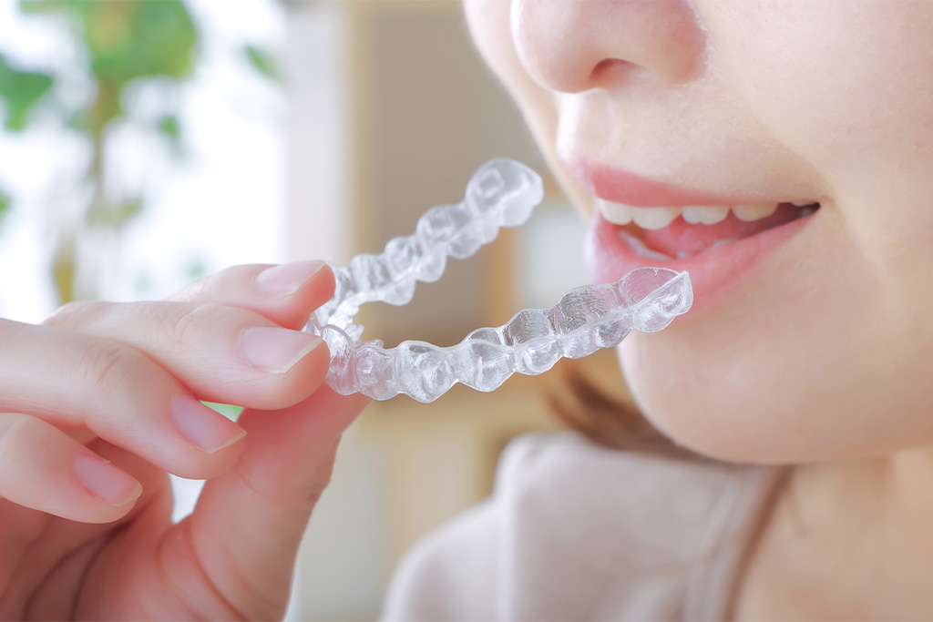 取り外しができる