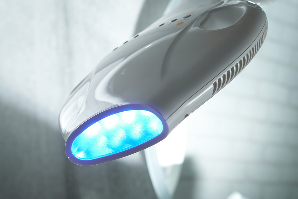 オフィスホワイトニングの場合